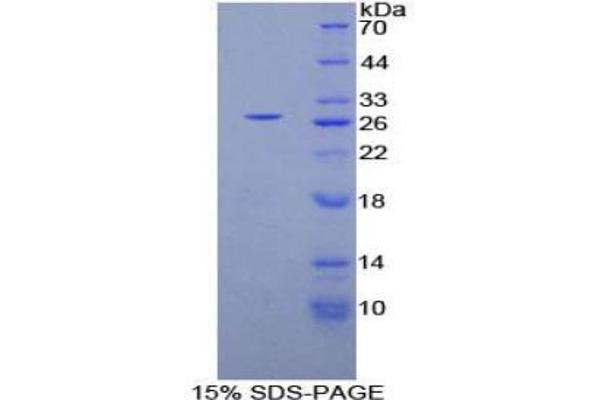 Phospholipase C gamma 1 Protéine