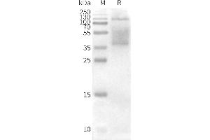 WB analysis of Human CD37-Nanodisc with anti-CD37 monoclonal antibody (ABIN7093065 and ABIN7272595), followed by Goat Anti-Human IgG HRP at 1/5000 dilution (CD37 Protéine)