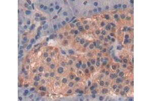 IHC-P analysis of Human Tissue, with DAB staining. (GRO gamma anticorps  (AA 35-107))