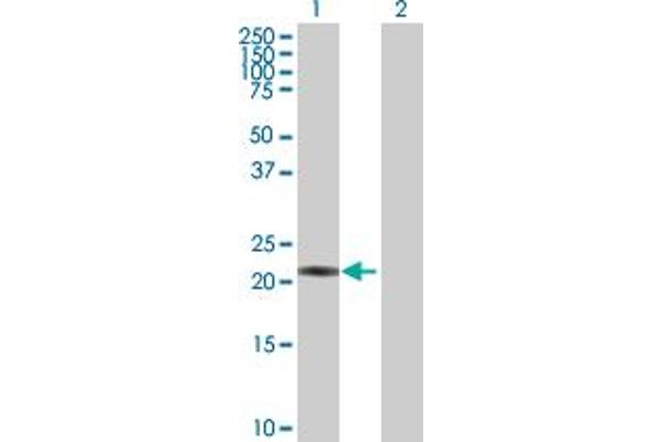 PSMB3 anticorps  (AA 1-205)