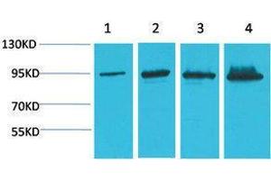Western Blotting (WB) image for anti-Catenin, beta (CATNB) antibody (ABIN3181549) (beta Catenin anticorps)