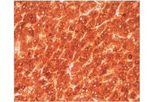 Image no. 1 for anti-alpha-Fetoprotein (AFP) antibody (ABIN950378) (alpha Fetoprotein anticorps)