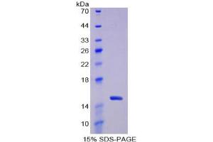 SDS-PAGE analysis of Rat Thioredoxin Protein. (TXN Protéine)