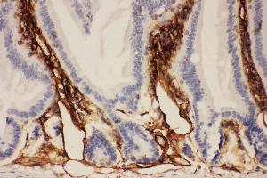 Immunohistochemistry (IHC) image for anti-Intercellular Adhesion Molecule 1 (ICAM1) (AA 198-537) antibody (ABIN3042515)