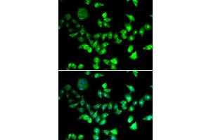 Immunofluorescence analysis of U2OS cells using SMC1A antibody. (SMC1A anticorps)