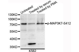 Western blot analysis of extracts of K562 cells, using Phospho-MAP3K7-S412 antibody. (MAP3K7 anticorps  (pSer439))