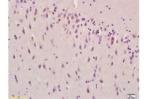 Formalin-fixed and paraffin embedded rat brain labeled with Anti Beta-synuclein/SNCB Polyclonal Antibody, Unconjugated (ABIN1387731) at 1:200 followed by conjugation to the secondary antibody and DAB staining (beta Synuclein anticorps  (AA 21-120))