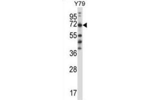 Western Blotting (WB) image for anti-Phenylalanyl-tRNA Synthetase, beta Subunit (FARSB) antibody (ABIN2997725) (FARSB anticorps)