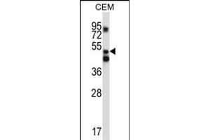 XPNPEP3 Antibody (C-term) (ABIN657127 and ABIN2846271) western blot analysis in CEM cell line lysates (35 μg/lane). (XPNPEP3 anticorps  (C-Term))