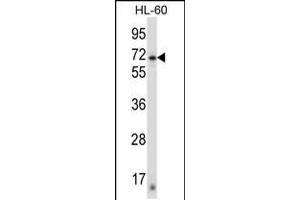 Western blot analysis in HL-60 cell line lysates (35ug/lane). (ZNF415 anticorps  (N-Term))