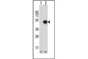 Western blot analysis of GCAT (arrow) using AKB ligase / GCAT Antibody (N-term) Cat. (GCAT anticorps  (N-Term))