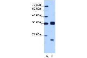 WB Suggested Anti-HNRPH3  Antibody Titration: 1. (HNRNPH3 anticorps  (N-Term))