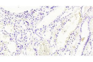 Immunohistochemistry (IHC) image for anti-Glyceraldehyde-3-Phosphate Dehydrogenase (GAPDH) (C-Term) antibody (ABIN185240)