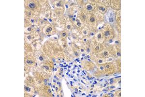 Immunohistochemistry of paraffin-embedded human liver injury using CARD11 antibody. (CARD11 anticorps)
