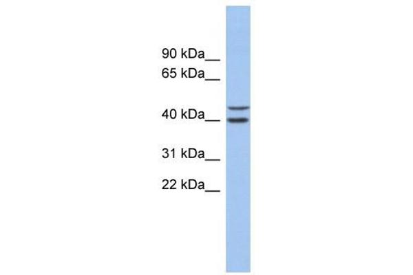 FBXL14 anticorps  (N-Term)