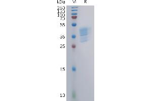 Human (1-39) Protein, mFc Tag on SDS-PAGE under reducing condition. (CCR4 Protein (AA 1-39) (mFc Tag))