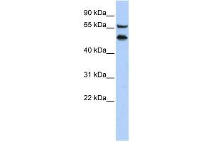 WB Suggested Anti-TADA2L Antibody Titration:  0. (TADA2L anticorps  (Middle Region))