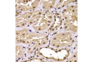 Immunohistochemistry of paraffin-embedded human kidney using CSRP2BP antibody (ABIN5975516) at dilution of 1/100 (40x lens). (CSRP2BP anticorps)