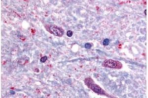 Human Spinal Cord (formalin-fixed, paraffin-embedded) stained with SLC5A3 antibody ABIN213396 at 40 ug/ml followed by biotinylated goat anti-rabbit IgG secondary antibody ABIN481713, alkaline phosphatase-streptavidin and chromogen. (SLC5A3 anticorps  (C-Term))