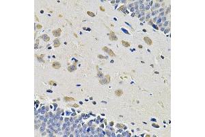 Immunohistochemistry of paraffin-embedded rat brain using ITGA2 Antibody (ABIN5974459) at dilution of 1/100 (40x lens). (ITGA2 anticorps)