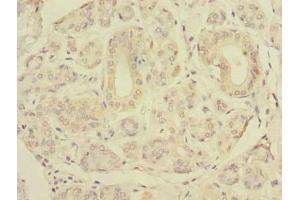 Immunohistochemistry of paraffin-embedded human salivary gland tissue using ABIN7151506 at dilution of 1:100 (SLC4A8 anticorps  (AA 1-300))
