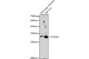Western blot analysis of extracts of various cell lines, using HOX antibody (ABIN7267764) at 1:1000 dilution. (HOXA9 anticorps)