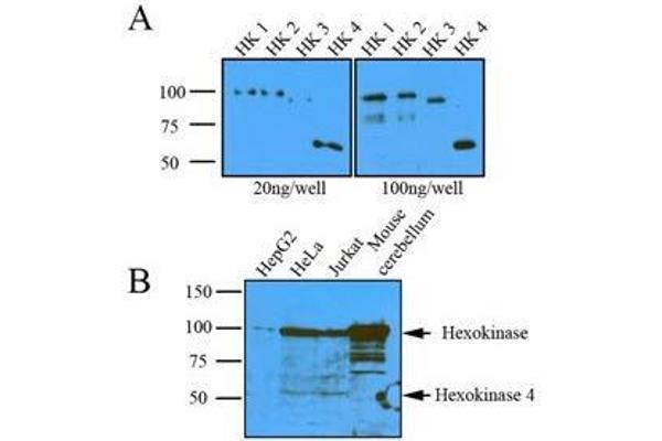 Hexokinase anticorps  (AA 1-917)