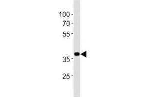 Western blot analysis of lysate from mouse stomach tissue lysate using Nkx2. (NK2 Homeobox 5 anticorps  (AA 192-235))