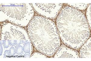 Immunohistochemical analysis of paraffin-embedded rat testis tissue. (Dynamin 1-Like anticorps)