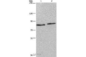 Western blot analysis of 293T and K562 cell, using ITGB2 Polyclonal Antibody at dilution of 1:600 (Integrin beta 2 anticorps)