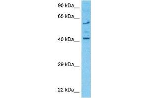 Host:  Rabbit  Target Name:  DTNB  Sample Type:  U937 Whole Cell lysates  Antibody Dilution:  1. (Dystrobrevin beta anticorps  (C-Term))