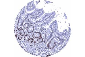 Duodenum mucosa (Recombinant SOX9 anticorps  (AA 393-508))