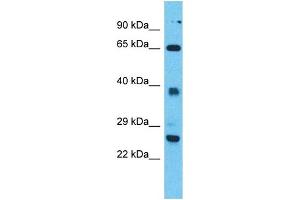 Western Blotting (WB) image for anti-Tetratricopeptide Repeat Domain 26 (TTC26) (N-Term) antibody (ABIN2500795) (TTC26 anticorps  (N-Term))