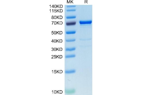 alpha Fetoprotein Protein (AA 19-609) (His tag)