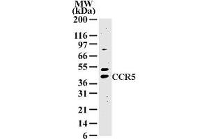 Image no. 1 for anti-Chemokine (C-C Motif) Receptor 5 (CCR5) (AA 324-340) antibody (ABIN208379) (CCR5 anticorps  (AA 324-340))