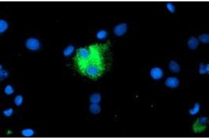 Image no. 3 for anti-Carboxypeptidase A1 (Pancreatic) (CPA1) antibody (ABIN1497592) (CPA1 anticorps)