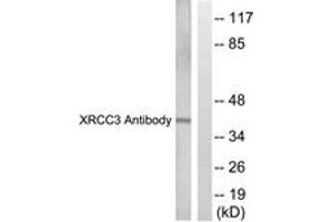 Western blot analysis of extracts from HepG2 cells, treated with Adriamycin 0. (RCC3 (AA 41-90) anticorps)