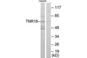 Western Blotting (WB) image for anti-Nerve Growth Factor Receptor (NGFR) (AA 121-170) antibody (ABIN2889383) (NGFR anticorps  (AA 121-170))
