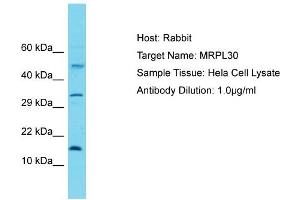 Host: Rabbit Target Name: MRPL30 Sample Tissue: Human Hela Whole Cell Antibody Dilution: 1ug/ml (MRPL30 anticorps  (C-Term))