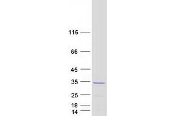 MRAS Protein (Transcript Variant 1) (Myc-DYKDDDDK Tag)