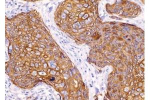 Immunohistochemistry (IHC) image for anti-Keratin 16 (KRT16) (C-Term) antibody (ABIN870561) (KRT16 anticorps  (C-Term))