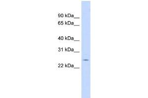 WB Suggested Anti-CRP Antibody Titration:  0. (CRP anticorps  (N-Term))
