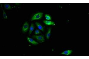 Immunofluorescence staining of A549 cells with ABIN7173891 at 1:400, counter-stained with DAPI. (FAS anticorps  (AA 26-171))