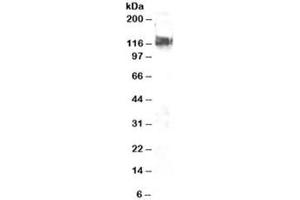 Western blot testing of NIH3T3 lysate with CBL antibody at 2ug/ml. (CBL anticorps)