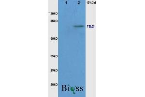 Lane 1: Mouse Liver, lysates Lane 2: Mouse Brain probed with Rabbit Anti-c-Raf(Ser338/Tyr340) Polyclonal Antibody, Unconjugated  at 1:3000 for 90 min at 37˚C. (RAF1 anticorps  (pSer338, pTyr340))
