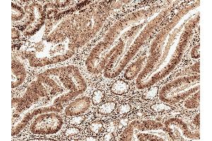 Immunohistochemistry analysis using Rabbit Anti-MCL 1 Polyclonal Antibody (ABIN5695933). (MCL-1 anticorps  (AA 70-170) (FITC))