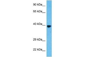 Host:  Rat  Target Name:  FOS  Sample Tissue:  Rat Liver  Antibody Dilution:  1ug/ml (c-FOS anticorps  (C-Term))
