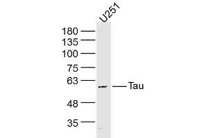 U251 lysates probed with Tau Polyclonal Antibody, Unconjugated  at 1:300 dilution and 4˚C overnight incubation. (tau anticorps)