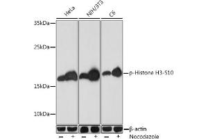 Western blot analysis of extracts of various cell lines, using Phospho-Histone H3-S10 Rabbit pAb (ABIN7267687) at 1:1000 dilution. (Histone 3 anticorps  (H3S10p))