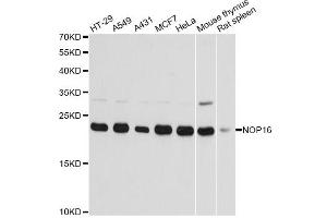 Western blot analysis of extracts of various cell lines, using NOP16 antibody (ABIN6293674) at 1:3000 dilution. (NOP16 anticorps)